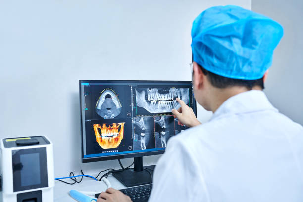 Best Emergency Treatment for Dental Infections or Abscesses in Springdale, OH